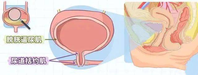马尾神经损伤病人,神经源性膀胱症状_治疗_患者_尿道