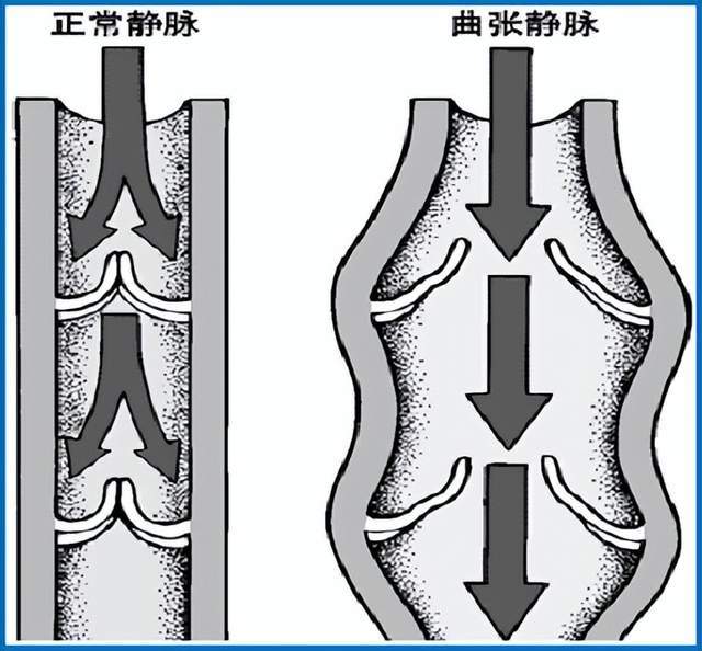 小叶下静脉图片