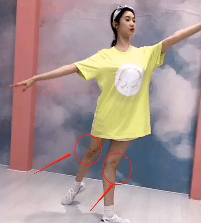 因为练舞的原因,学舞蹈的腿都需要经常被要求压腿,而在张艺凡的膝盖上