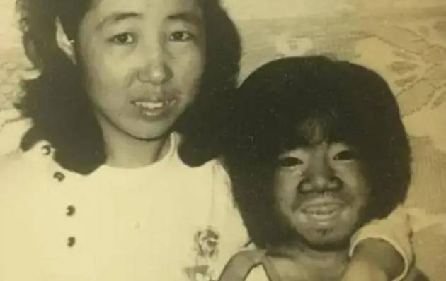 "中国第一毛孩"于震寰,为恋爱被逼脱毛,42岁娶娇妻喜获爱子