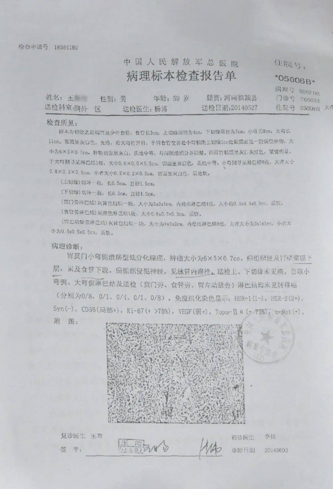 癌症检验报告单图片