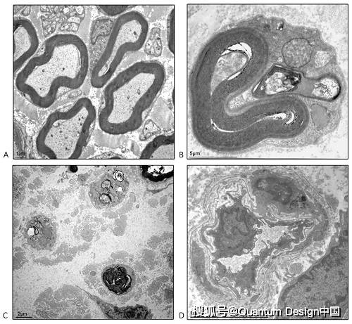 lvem25低电压台式透射电子显微镜观察离体尾神经的成像结果显示,在pn