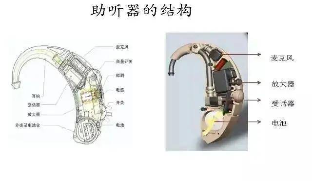 耳道式助听器结构图图片