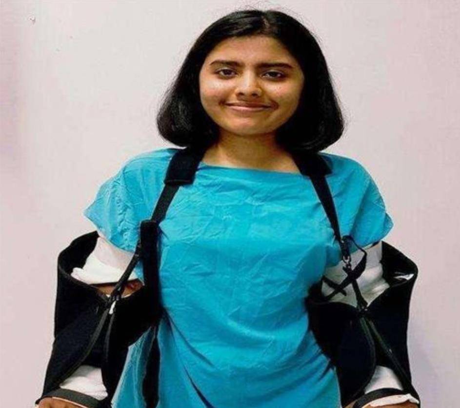 原创印度姑娘因车祸失去双臂移植黑人手臂两年后全身皮肤开始变黑