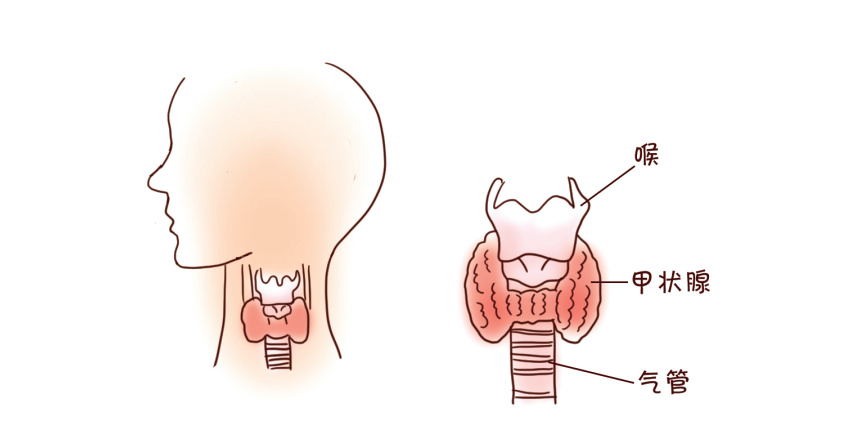 甲状腺问题到底该补碘还是限碘