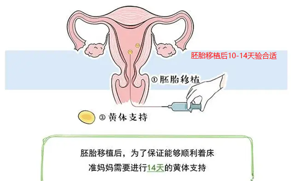 胚胎移植着床后还需要保胎吗