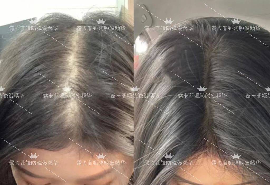 熬夜族必看防脱育发哪个牌子最有效护发好物大合集