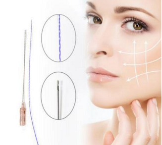 埋线提升面部可以维持多久线雕面部提升能保持多长时间