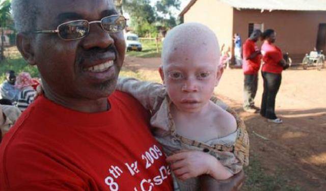 非洲有一特殊人群,血液比"黄金"还宝贵,警察24小时贴身保护_黑人_肤色