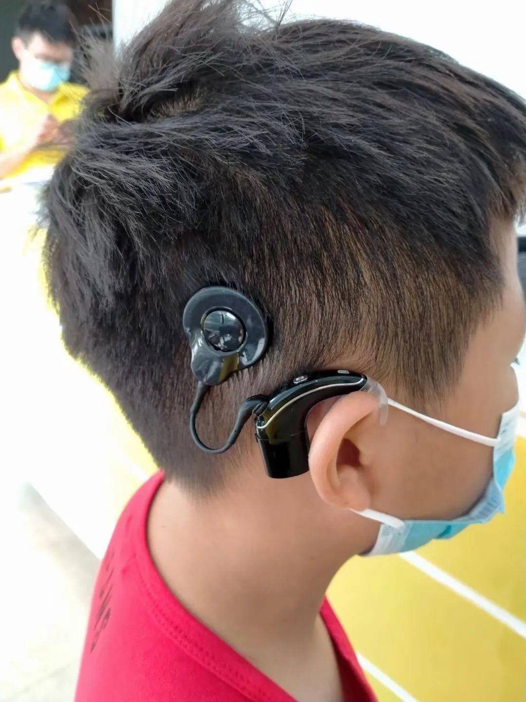 这个"小耳朵"不简单!能让听障人士回归"有声世界"