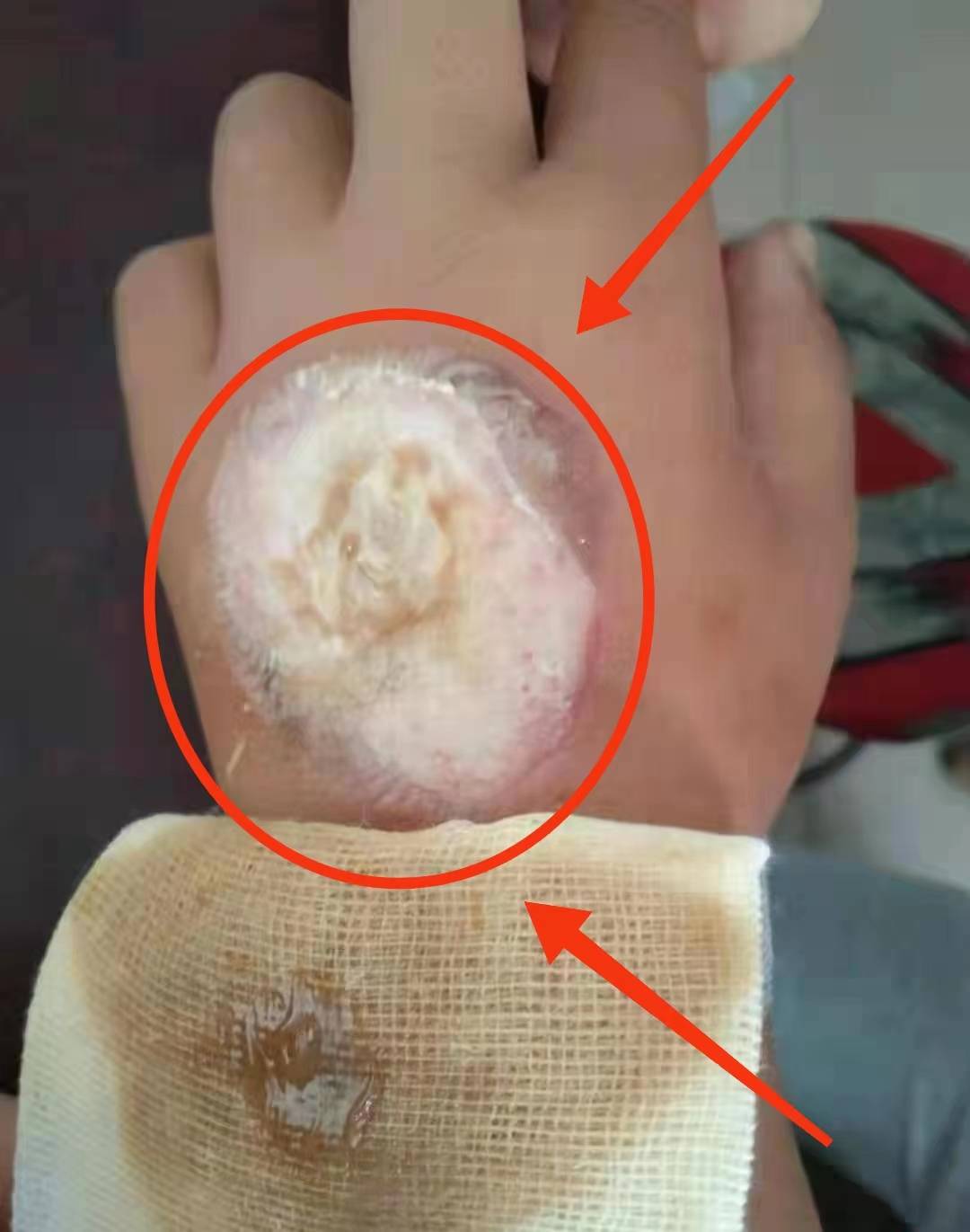 初一女生遭学姐烫伤凌辱7位施暴者6人免责最重的1人才罚500元