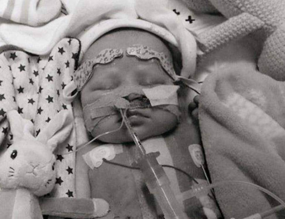 1984年美国母亲不顾各方谴责为初生女儿移植狒狒心脏结果如何