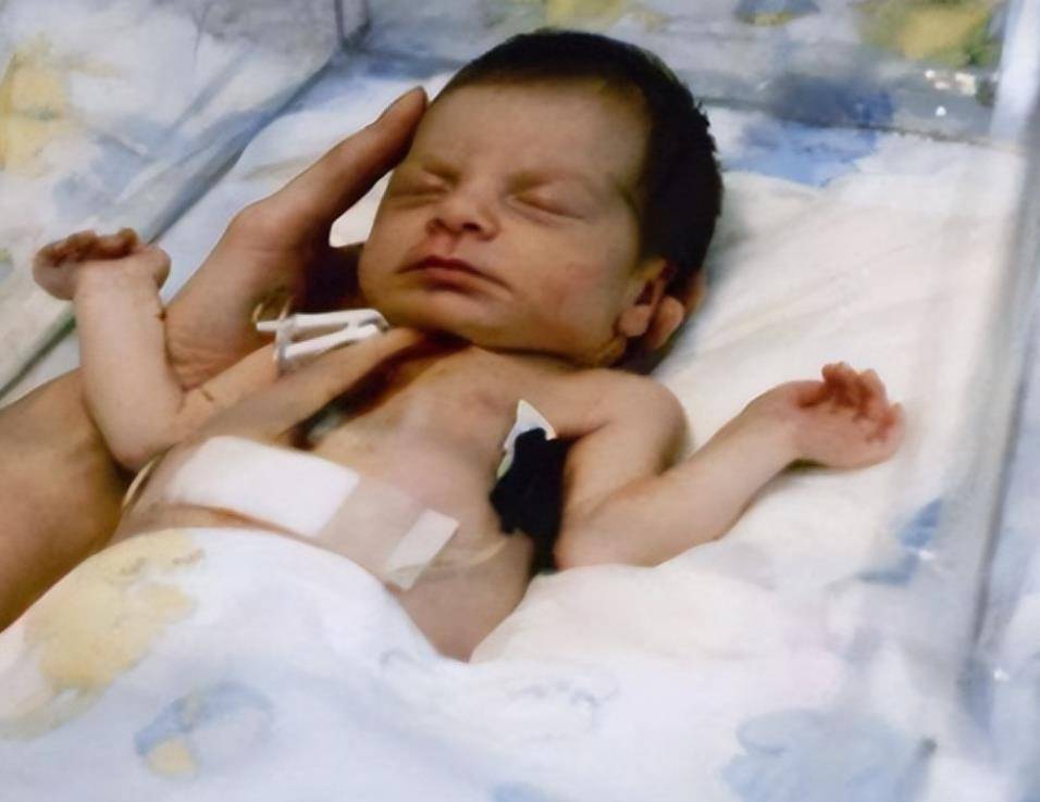 守在手术室外的特蕾莎也收到了好消息,她高兴地不知所以,流下了喜悦的