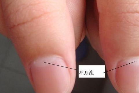 身体好不好从指甲的半月痕找信号
