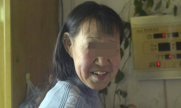15岁却长着张60岁的脸,2019年"换脸"成功_谷女士_小凤_女儿