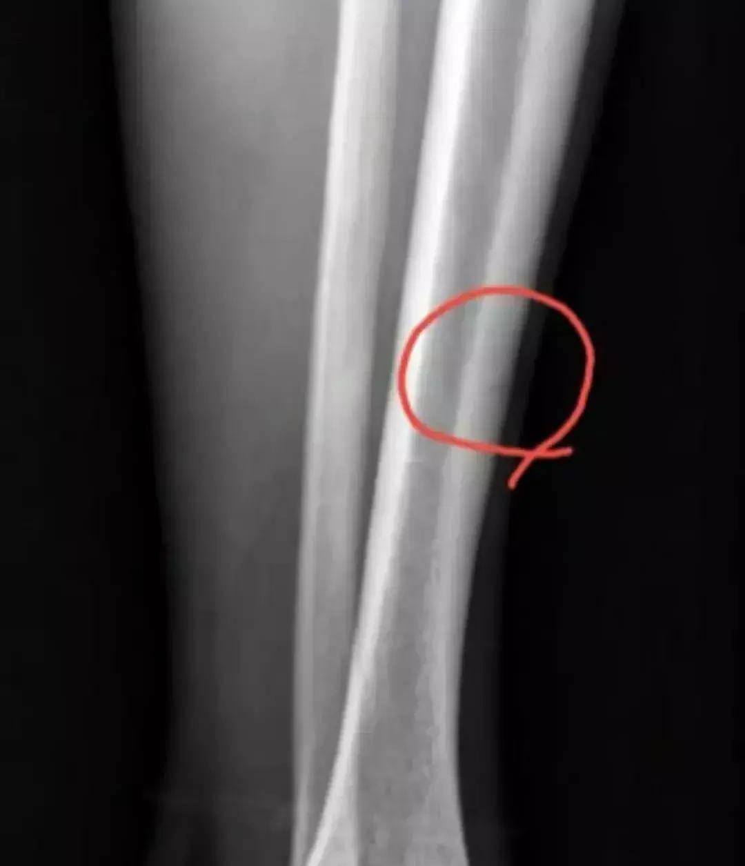 孙铭徽伤情公开,广厦提前退出争冠行列,辽篮卫冕只需提防这三队