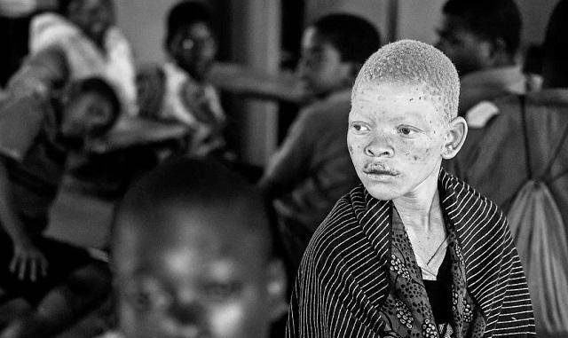 原创非洲版唐僧身体被人觊觎血液堪比黄金遗骸能卖上百万