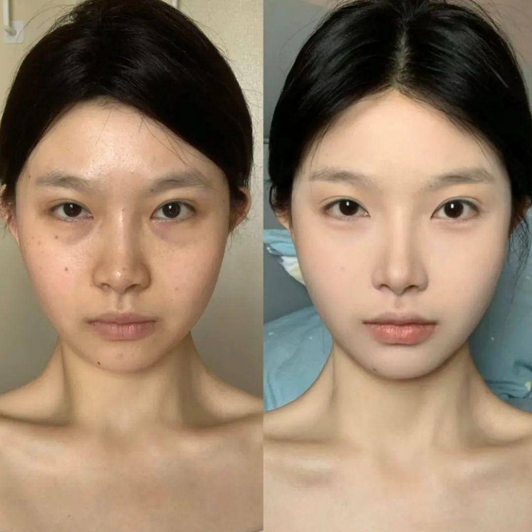 赵丽颖新剧脸怎么变这样了这次真的夸不出口