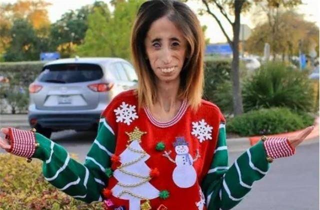 400万人咒她去死,这个被称为"全球最丑的女人",终于选择反击