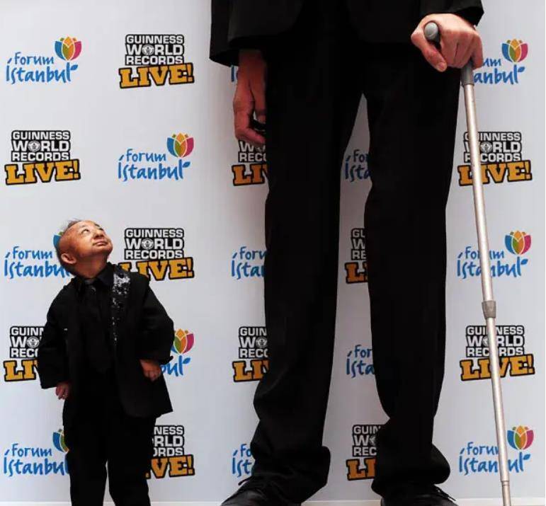 原创2010年前世界第一矮人何平平猝然离世21岁未结婚成最大遗憾