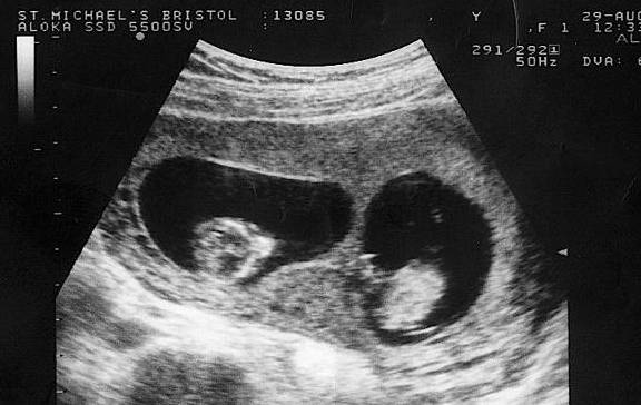 原创验孕棒一深一浅到底怀上了吗其实也可能是这4种情况