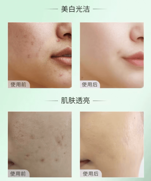 这次还用了他们家的洁面乳,和普通的洗面奶比起来,洗完脸之后脸部干燥