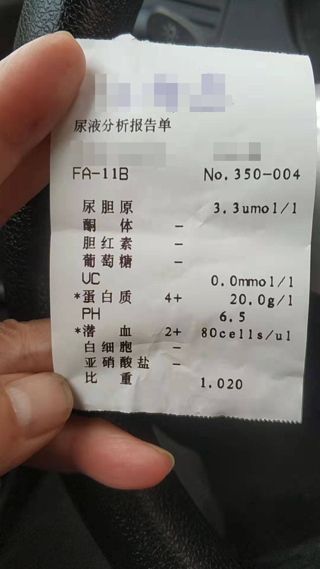 问止中医陈碧琴医师又一例慢性肾炎蛋白尿尿潜血