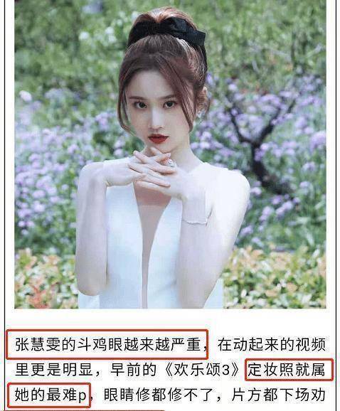 原创被嫌弃张慧雯被曝因斗鸡眼导致定妆照难看片方还劝她去做手术