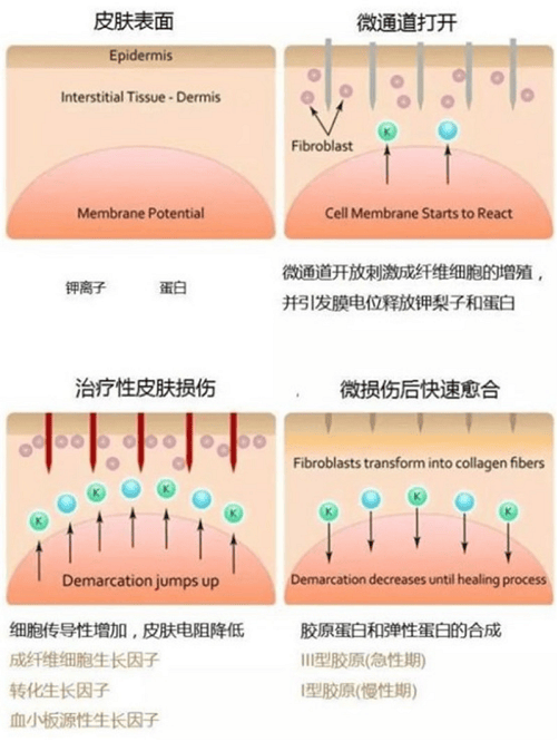 瞧瞧打了水光针需要注意什么打完水光针多久可以洗脸