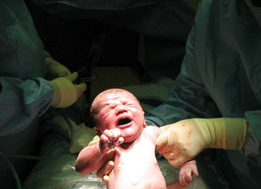 产妇宫缩三天后坚持顺产，孩子出生后医生却摇头叹息_小静_婆婆_胎儿