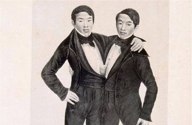 原创连体人怎样结婚生子泰国连体兄弟娶了一对姐妹生育了22个孩子