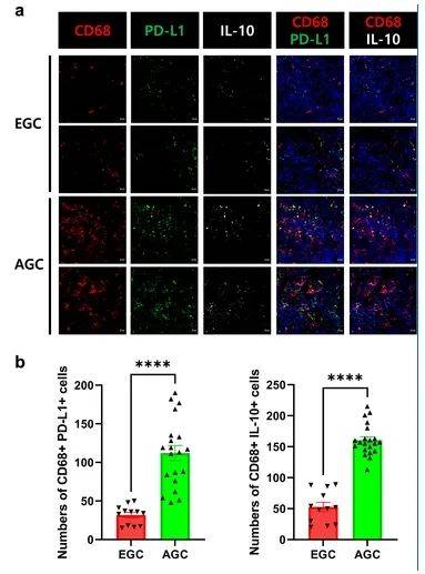 肠道微生物组衍生的丁酸盐抑制胃癌肿瘤相关巨噬细胞中的免疫抑制因子