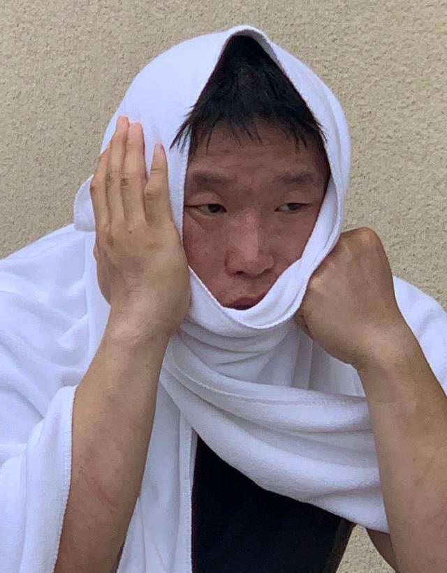 德云社烧饼满脸晒得通红胳膊还受伤了网友纷纷开始埋怨节目组