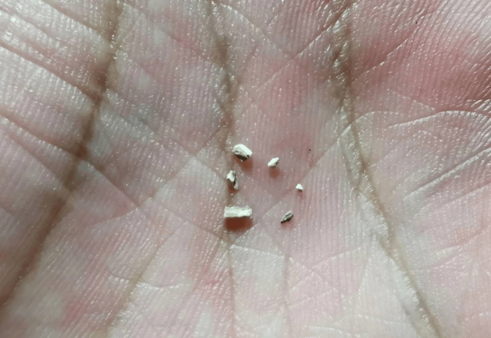 牙结石又黄又黏腻!过来人教你一招,牙石唰唰唰全掉!