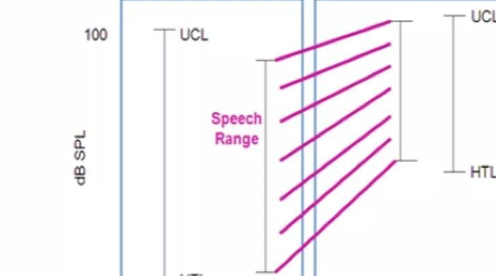 原创助听器调了n次都不行不如试试这8大验配技巧