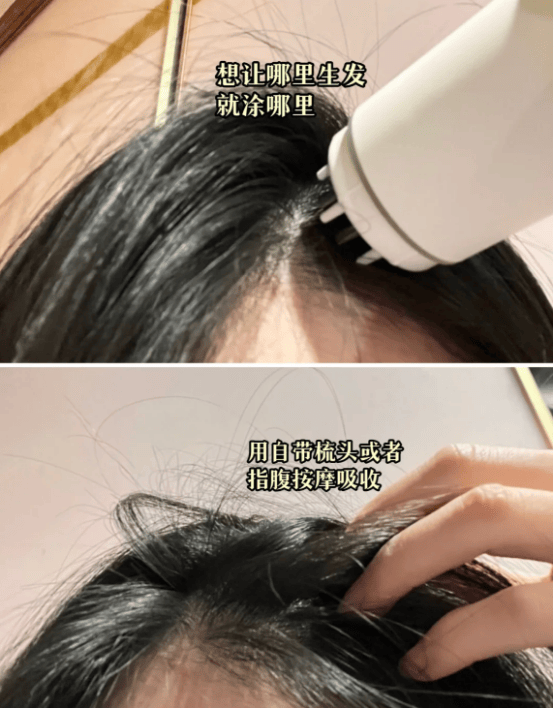 热门育发液这样选就对了不想踩雷的进