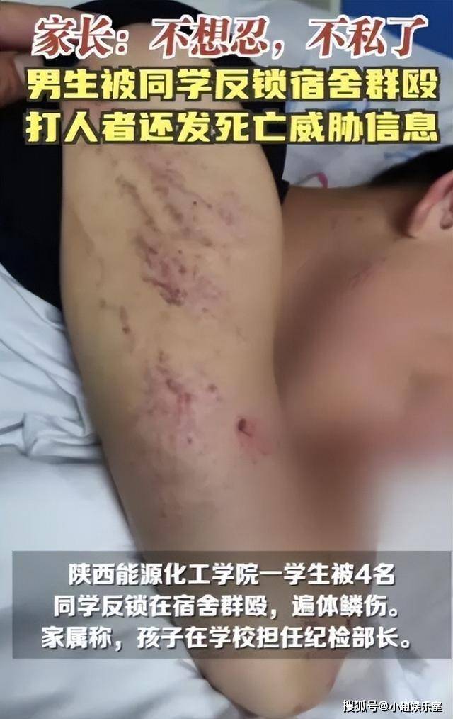 打架受伤的图片男生图片