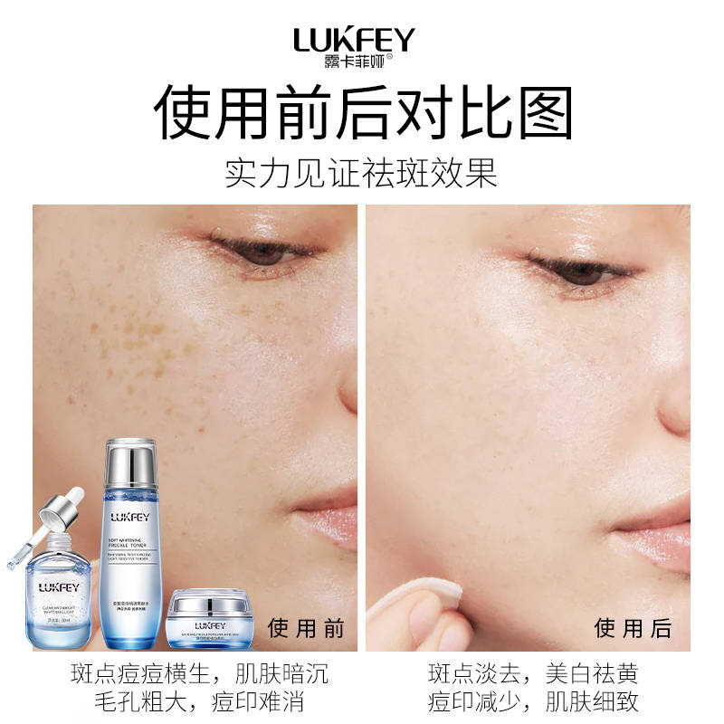 淡斑精华液排行榜10强,祛斑要好好做功课