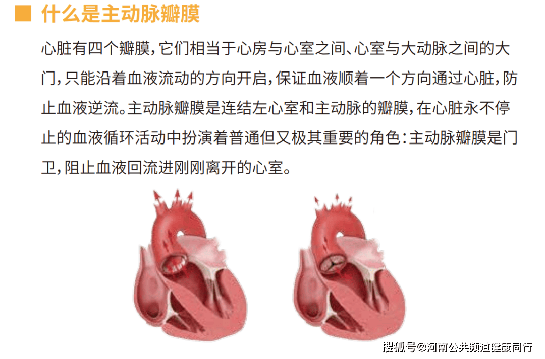 心瓣膜置换图片