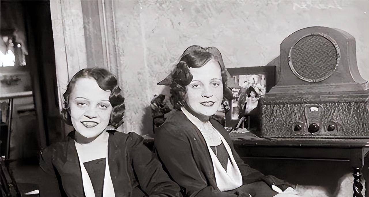 臀部连体姐妹:无法正常结婚,姐姐死后,妹妹与遗体共存2天去世