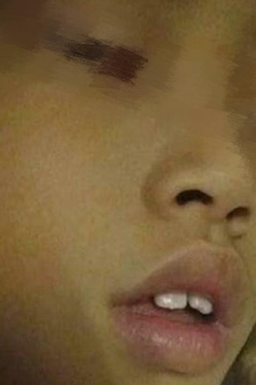 挺可爱的孩子结果越长越丑,甚至像"猩猩"?检查之后宝妈后悔了