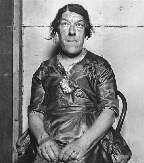 因一场病变成怪物,她为养活四个孩子,不顾嘲讽参加选丑比赛赚钱_玛丽