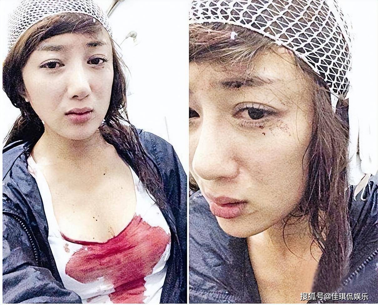 她曾是"古装第一美人",被狗咬毁容后,40岁靠演恶毒女配翻身