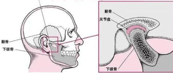 详细说:下颌角削骨整形手术,下颌角整形手术术后效果