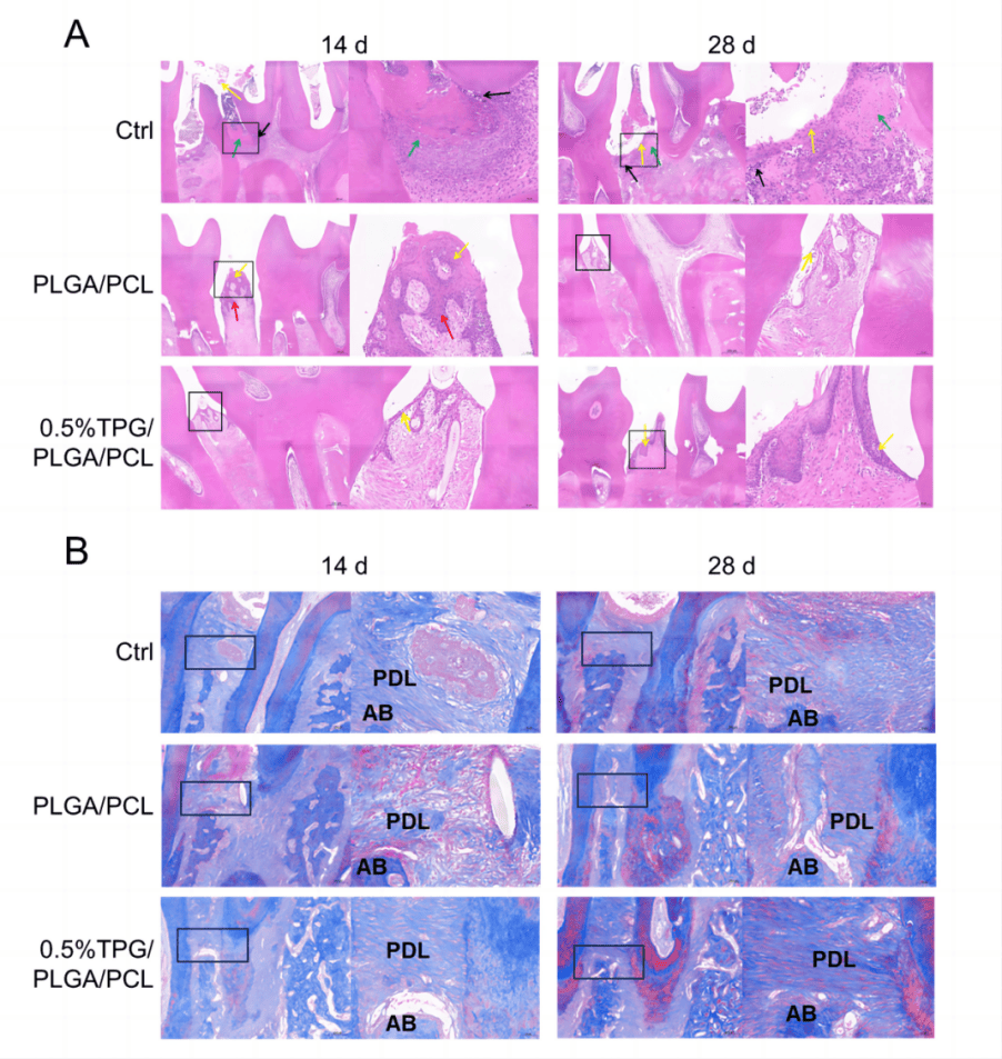 5%的tpg/plga/pcl组col-1的表达增加.