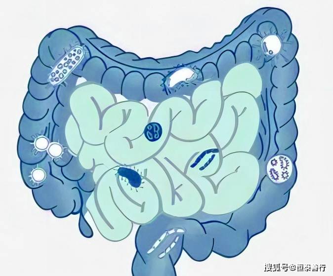 肠道菌群与癌症之间的潜在联系
