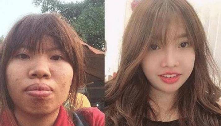 女子花巨资整容嫁富二代,5个月后生娃现原形被甩,现今现状如何