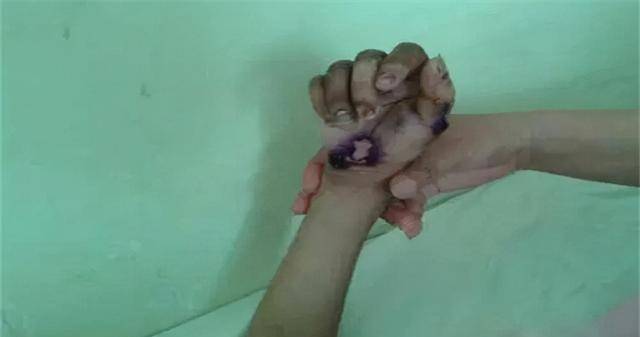 燕志云想要儿子不成,心生恨虐死6岁女儿,出狱后挖女儿骨灰泄愤