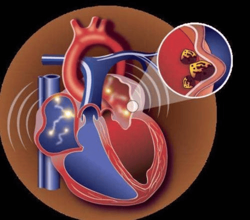 心脏不好,身体会有4个表现,一旦出现,试着去做2个检查
