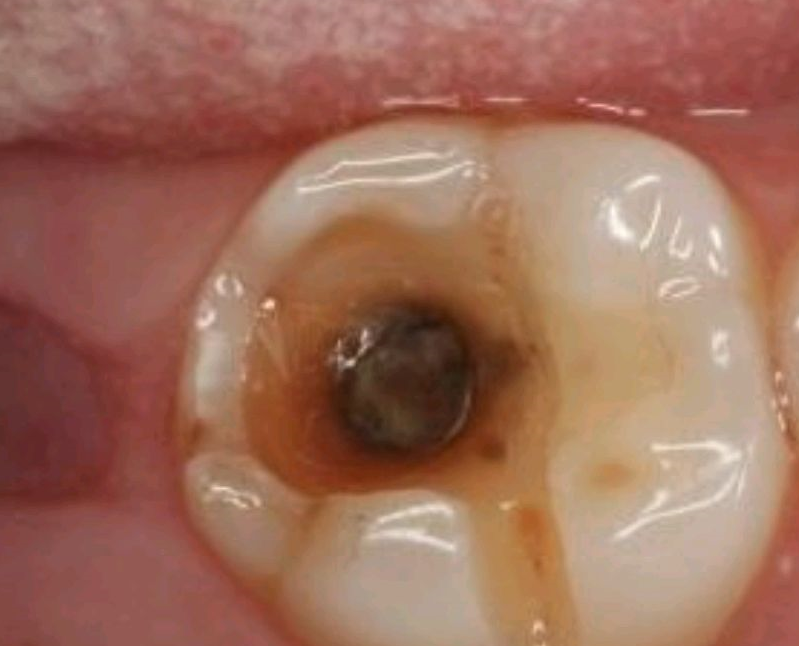 牙齿_影响_老年人